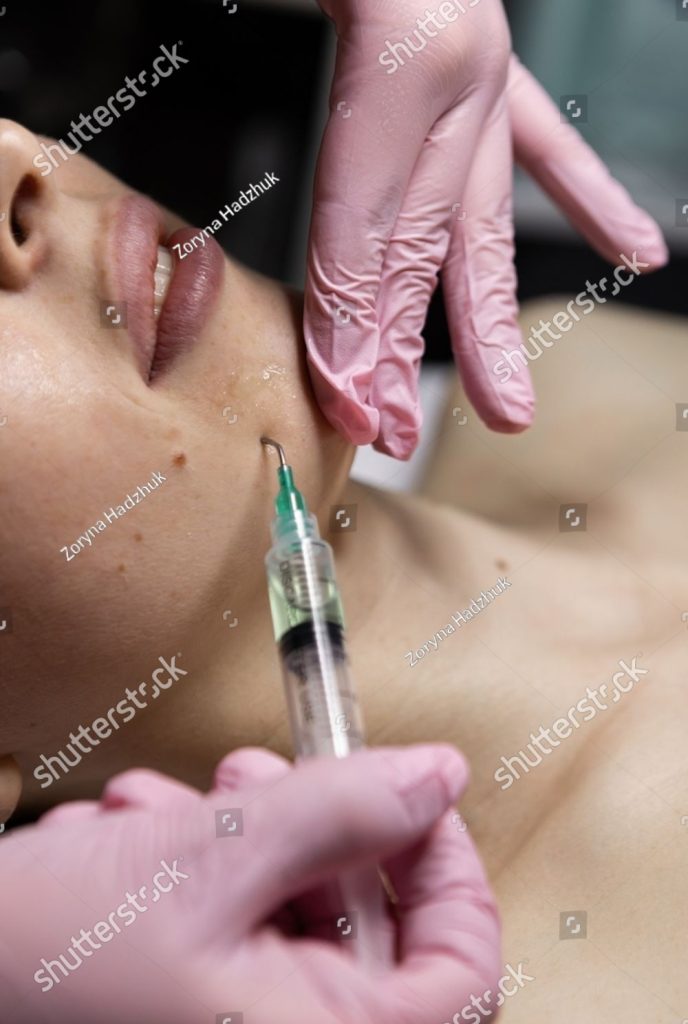 dermal fillers below banner